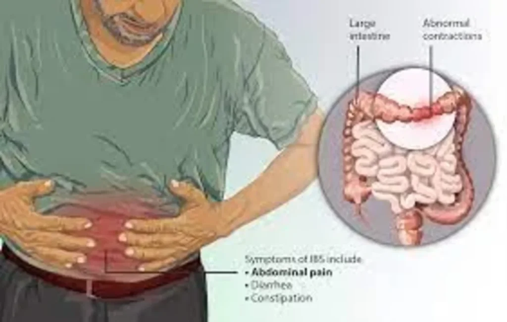 Causes of Constipation