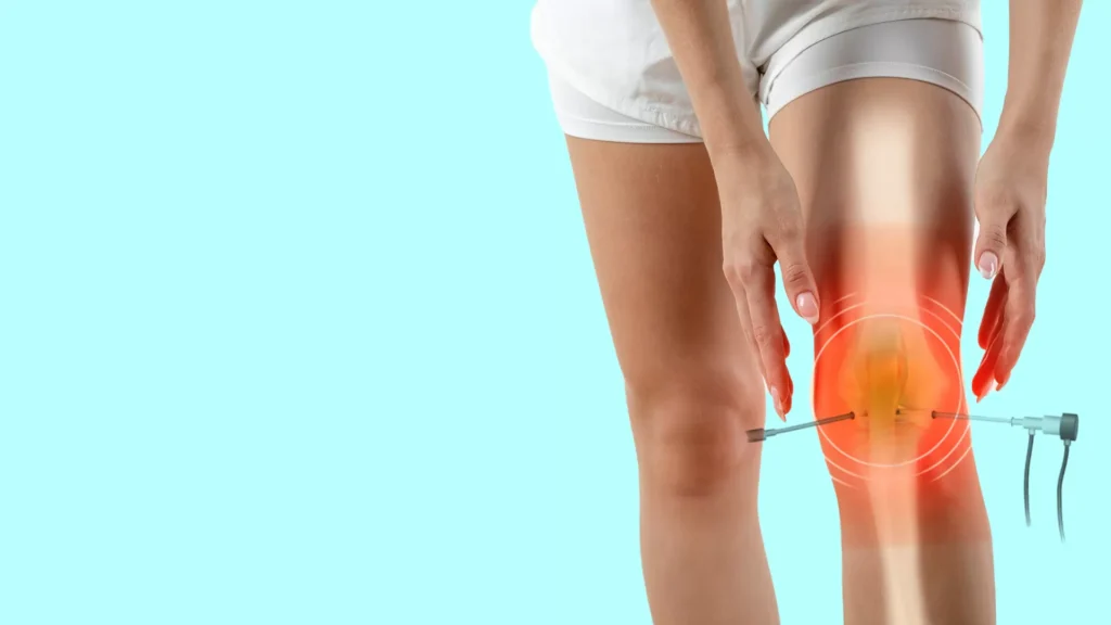 Arthroscopic Knee Debridement in Iran